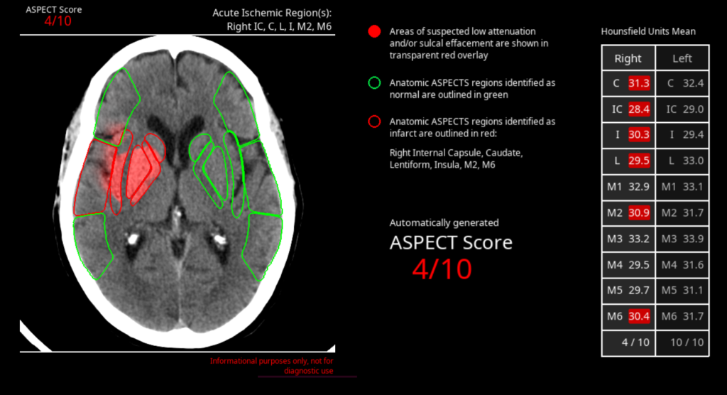 ai tools for neuro
