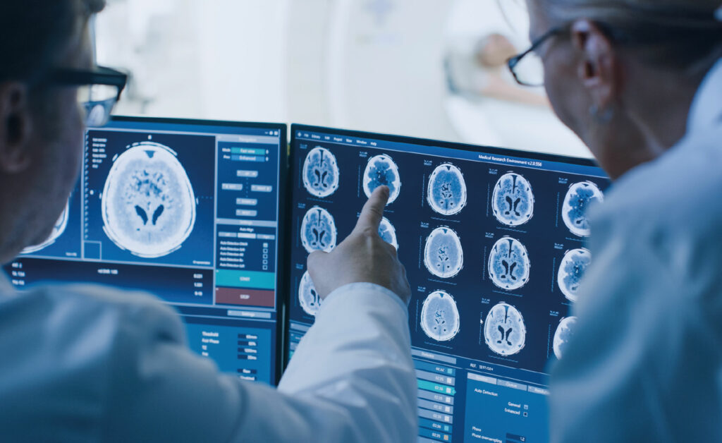 Brain CT scan