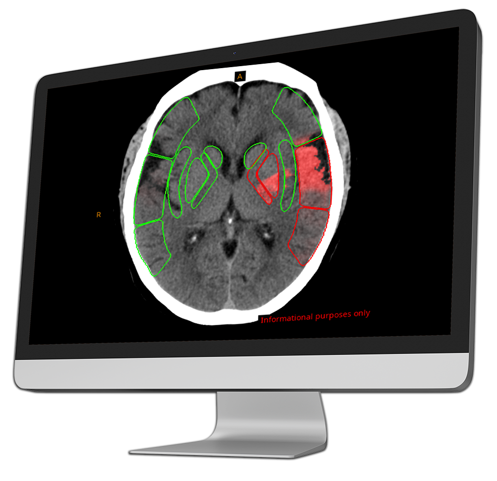 ai radiology output-into-computer