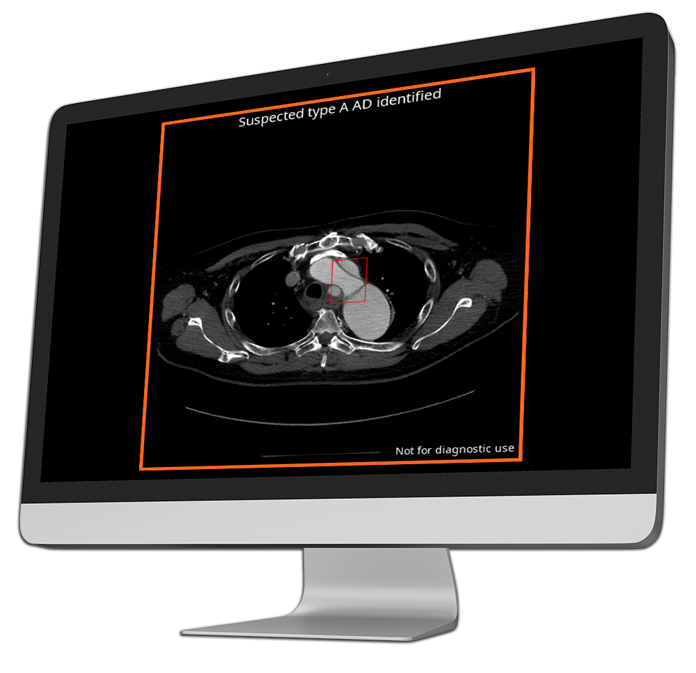ai radiology output-into-computer