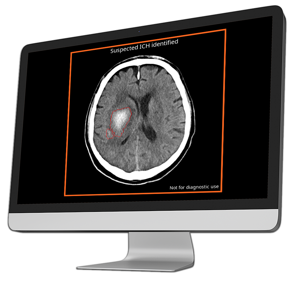 ai radiology output-into-computer