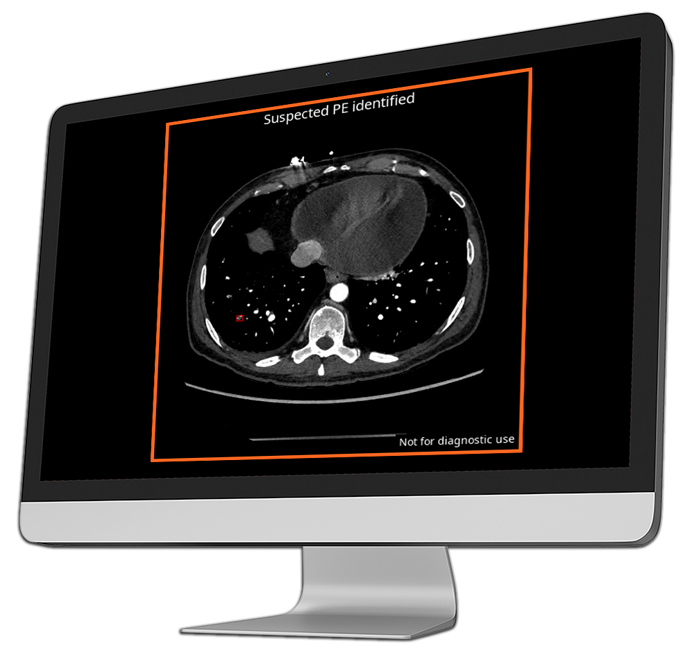 ai radiology output-into-computer