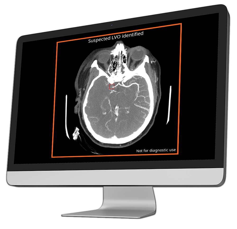 ai radiology output-into-computer
