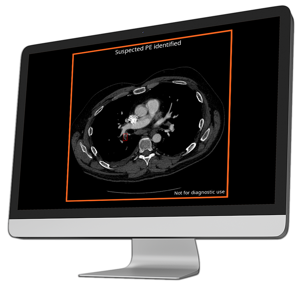 ai radiology output-into-computer