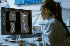 PR CE Marking CSpine web Radiology Ai Tool