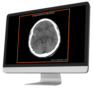 AI Intracranial Hemorrhage Detection For Stroke & Trauma | Avicenna.AI