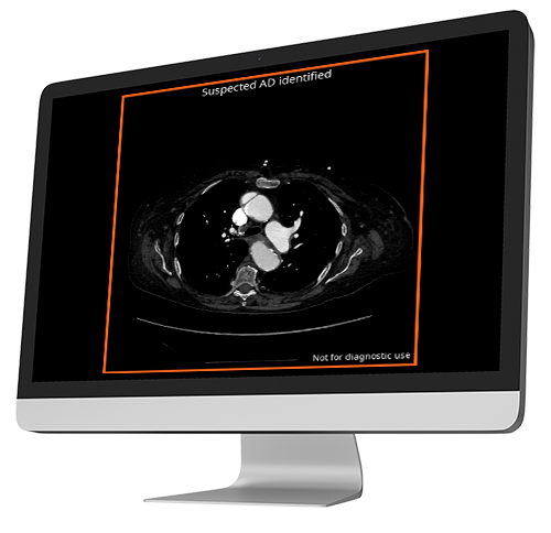 output into computer 4