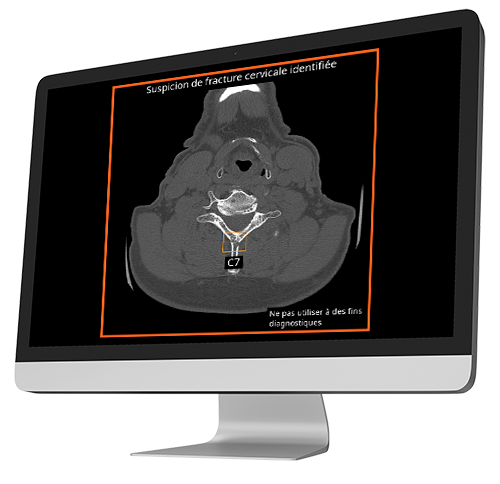 output-into-computer-cspine-ous-axial