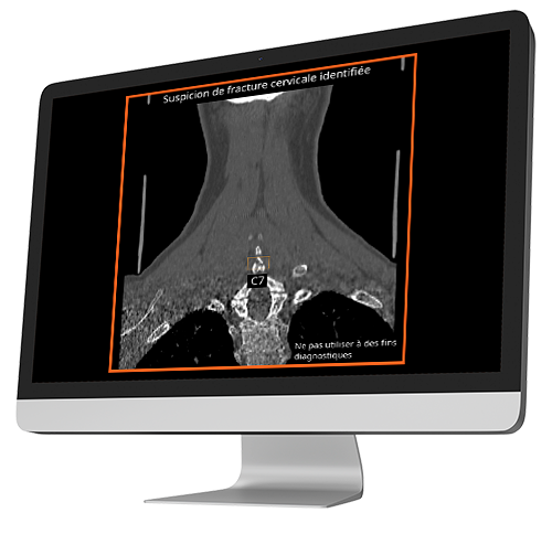 output-into-computer-cspine-ous-coronal