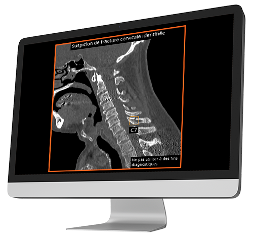 output-into-computer-cspine-ous-sagittal