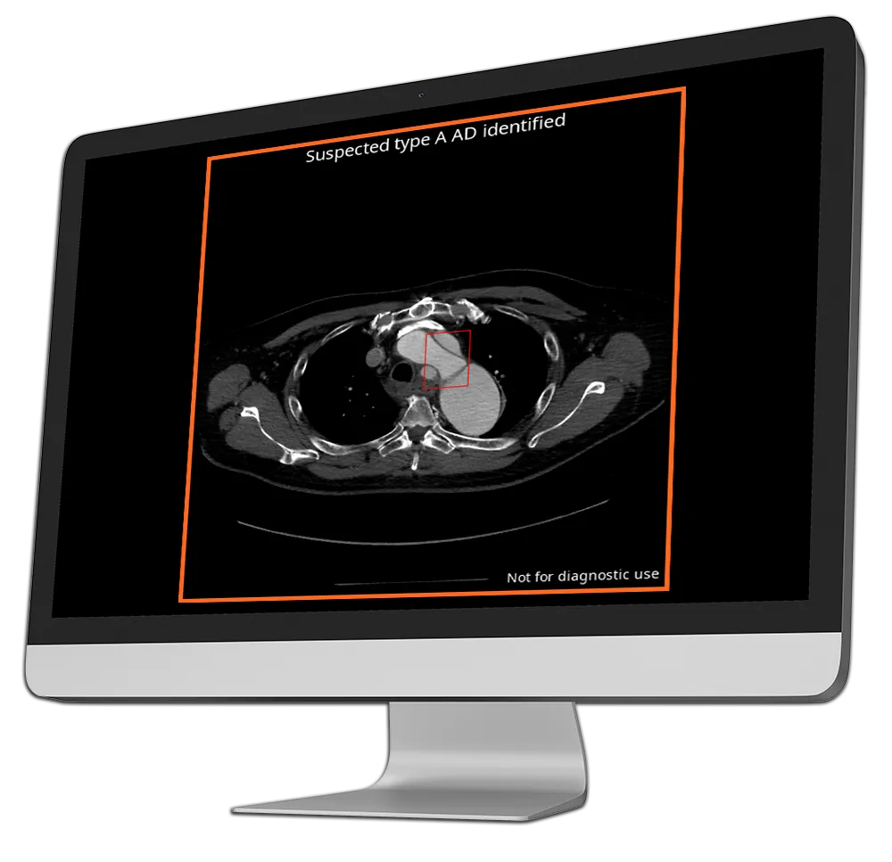 v4 tools output ad ous
