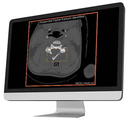 v4 tools output cspine ous axial en