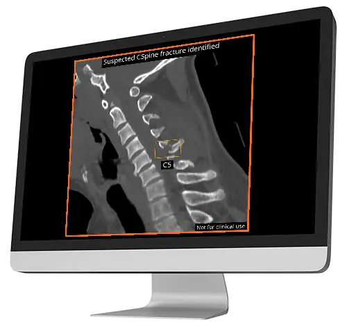 cina-cspine output in pacs
